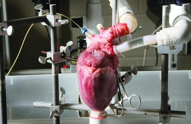 Bệnh nhân được ghép tim heo lần đầu tiên trên thế giới - Ảnh 3