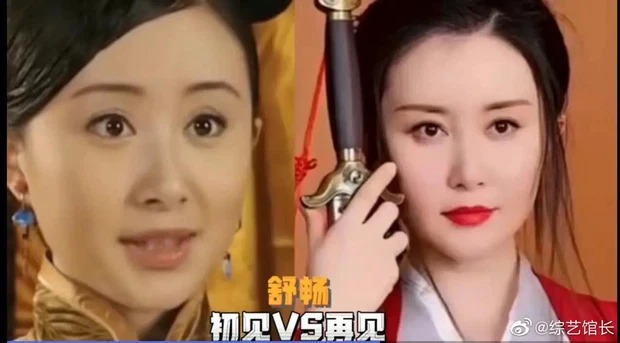 Dàn sao Cbiz xuống sắc thảm hại: Người đẹp 'Đông Cung' tàn tạ, 'đệ nhất mỹ nữ cổ trang' tan tành sự nghiệp vì dao kéo - Ảnh 16