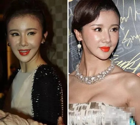 Dàn sao Cbiz xuống sắc thảm hại: Người đẹp 'Đông Cung' tàn tạ, 'đệ nhất mỹ nữ cổ trang' tan tành sự nghiệp vì dao kéo - Ảnh 13