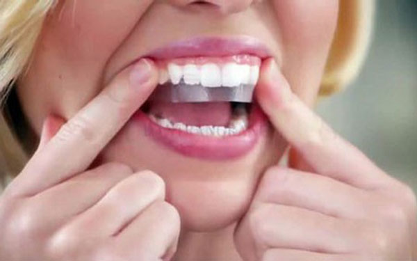 Sở hữu hàm răng trắng sáng ngay tại nhà với những thủ thuật đơn giản ai cũng làm được - Ảnh 3