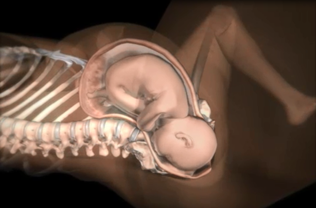 Những điều các mẹ cần biết về tình huống đẻ khó do bé bị kẹt vai trong lúc sinh thường - Ảnh 2