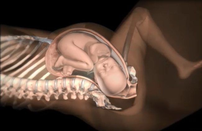 Những điều các mẹ cần biết về tình huống đẻ khó do bé bị kẹt vai trong lúc sinh thường - Ảnh 3