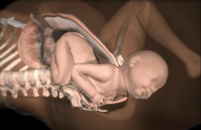 Những điều các mẹ cần biết về tình huống đẻ khó do bé bị kẹt vai trong lúc sinh thường - Ảnh 4