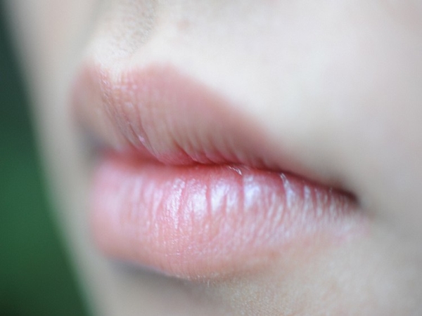 5 dấu hiệu bất thường ở đôi môi mà bạn không nên chủ quan bỏ qua - Ảnh 2