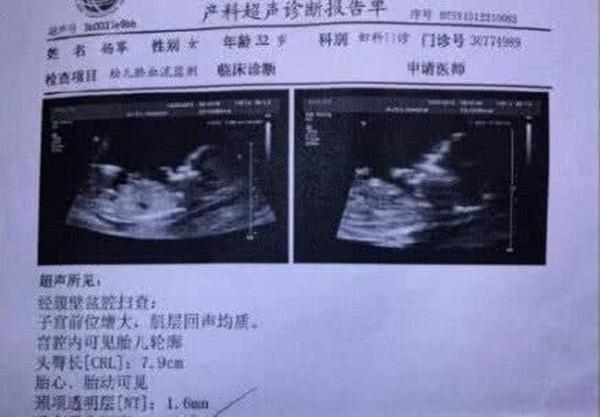 Cộng đồng mạng ‘dậy sóng’ trước tin đồn Dương Mịch có thai 3 tháng, lộ cả kết quả siêu âm - Ảnh 1