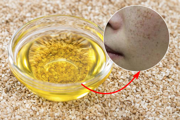 Ở nhà có sẵn lọ dầu mè mà không biết đến 8 cách dùng để trị mụn, chống lão hóa và dưỡng trắng da này thì quá phí 'thần dược' trời ban - Ảnh 3