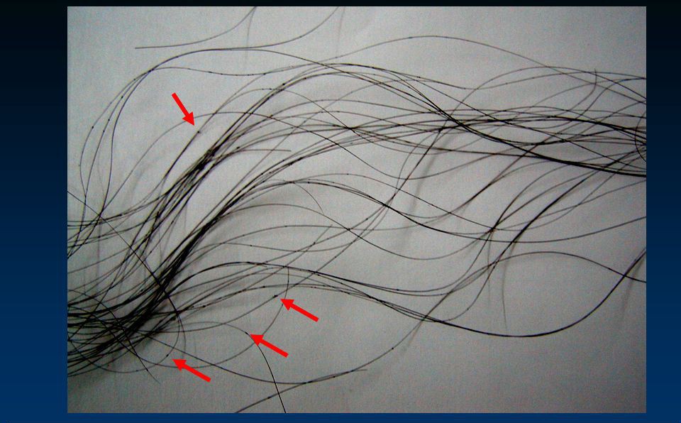 Từ thói quen nhiều bạn gái hay mắc phải đến căn bệnh trứng tóc không thể coi thường - Ảnh 2