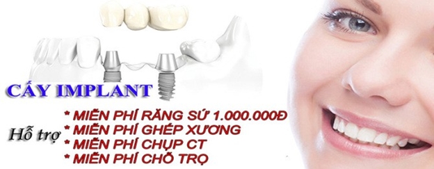 Cách để có giá trồng răng Implant rẻ nhất - Ảnh 5