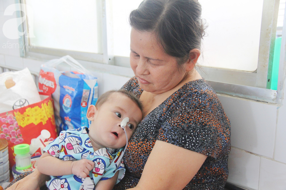 Ánh mắt cầu cứu của bé trai 7 tháng tuổi bị mẹ bỏ rơi trước cổng chùa vì mắc bệnh bại não - Ảnh 1
