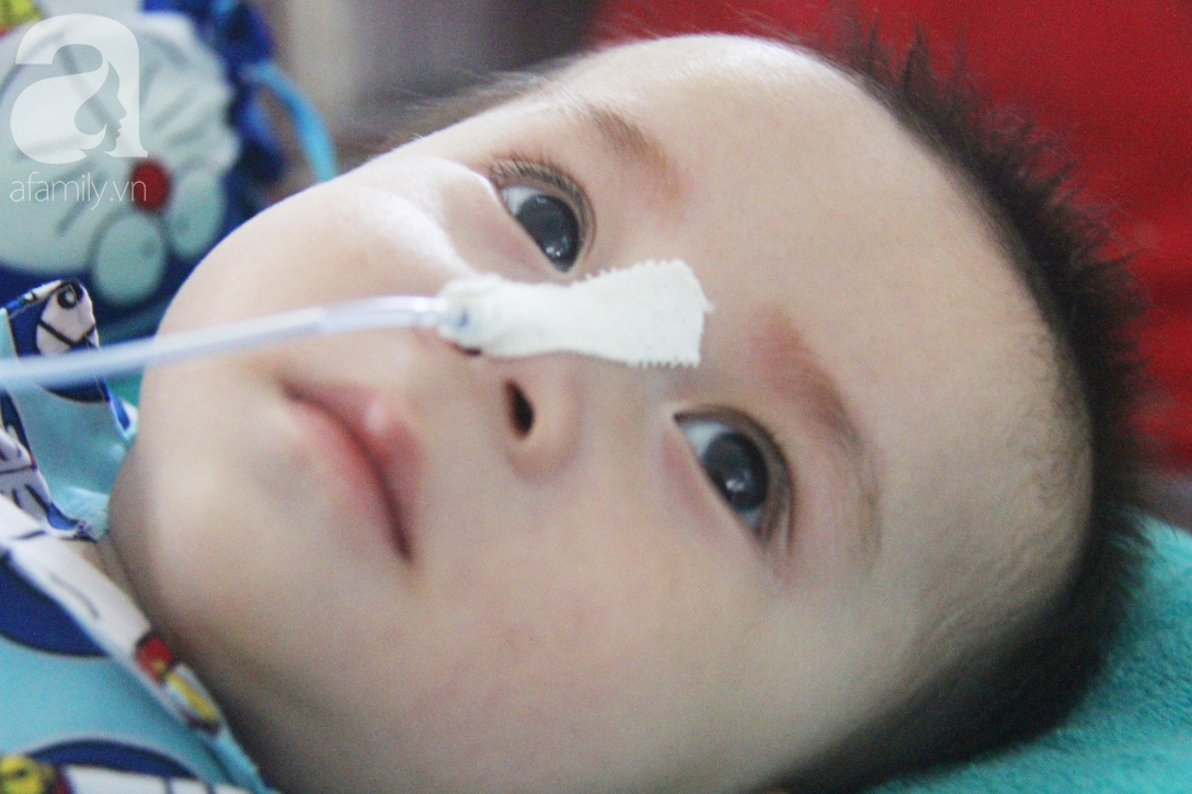 Ánh mắt cầu cứu của bé trai 7 tháng tuổi bị mẹ bỏ rơi trước cổng chùa vì mắc bệnh bại não - Ảnh 3