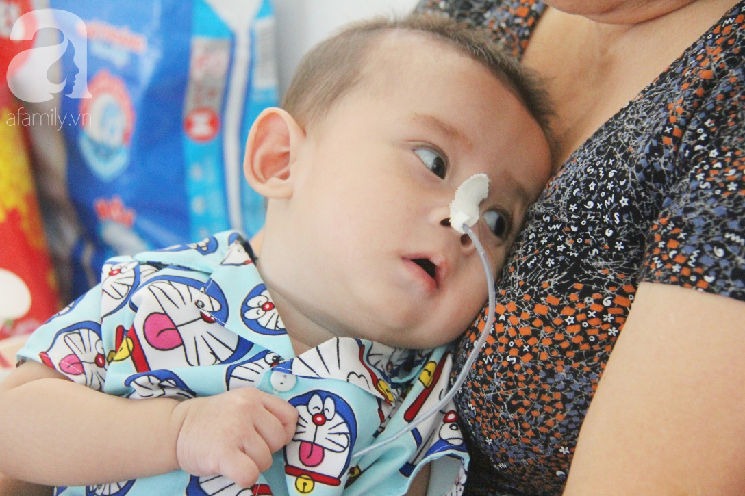 Ánh mắt cầu cứu của bé trai 7 tháng tuổi bị mẹ bỏ rơi trước cổng chùa vì mắc bệnh bại não - Ảnh 5