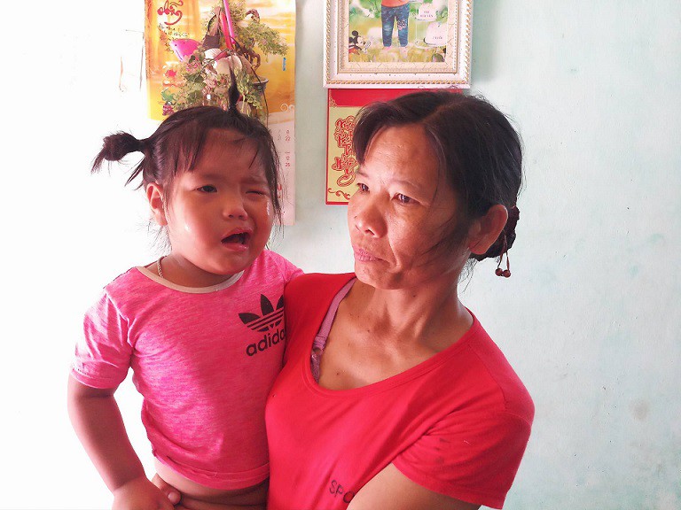 Bé gái 3 tuổi méo miệng, liệt dây thần kinh sau khi bị cô giáo đánh: Mẹ mắc bệnh ung thư, gia cảnh nghèo khó - Ảnh 1