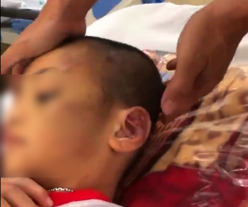 Tây Ninh: Mẹ ruột đánh đập con trai 6 tuổi bầm dập cả người - Ảnh 1
