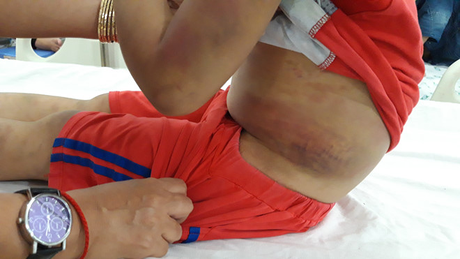 Tây Ninh: Mẹ ruột đánh đập con trai 6 tuổi bầm dập cả người - Ảnh 3