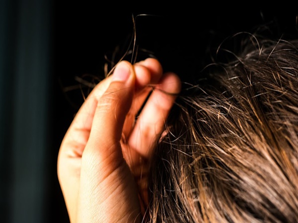 Cảnh báo: Thuờng xuyên bứt tóc, nhổ lông mi coi chừng là dấu hiệu bệnh tâm thần - Ảnh 4
