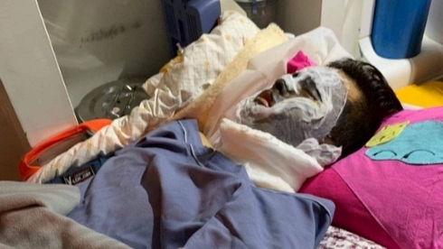 Việt kiều bị tạt axit, cắt gân chân: Người bố tiết lộ nguyên nhân anh trai nạn nhân vội vã rời Việt Nam - Ảnh 1