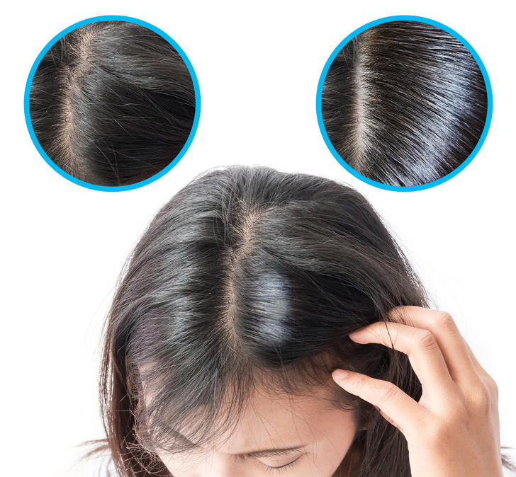 8 bí quyết cực đơn giản giúp mái tóc hư tổn, khô xơ trở nên mềm mượt, óng ả như hình quảng cáo - Ảnh 3