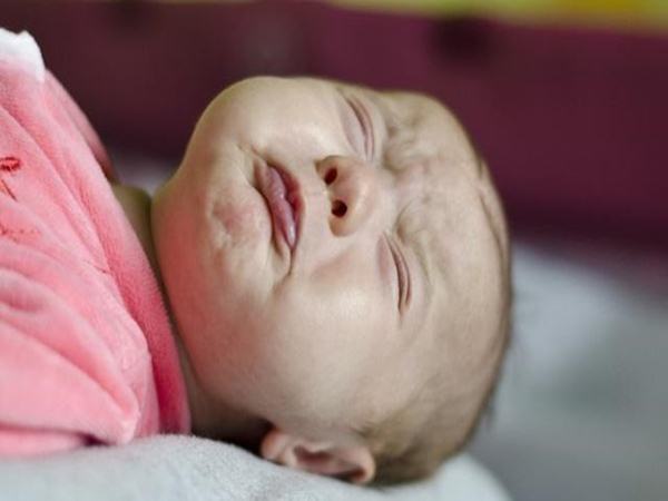 Con gái 7 tháng tuổi la khóc vì bị viêm sưng vùng kín, bác sĩ chỉ ra sai lầm của người mẹ và nhiều phụ huynh khác - Ảnh 1