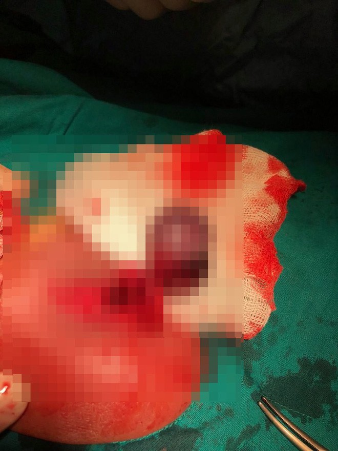 Ninh Thuận: Bé trai 9 tuổi bị hoại tử tinh hoàn phải cắt bỏ vì căn bệnh 'quái dị' - Ảnh 1