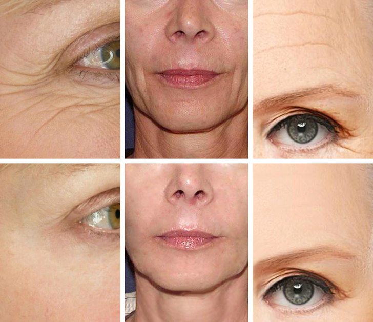 5 loại dưỡng chất chống lão hóa, kéo căng da mặt giúp phụ nữ níu kéo tuổi xuân hiệu quả như thẩm mỹ - Ảnh 1