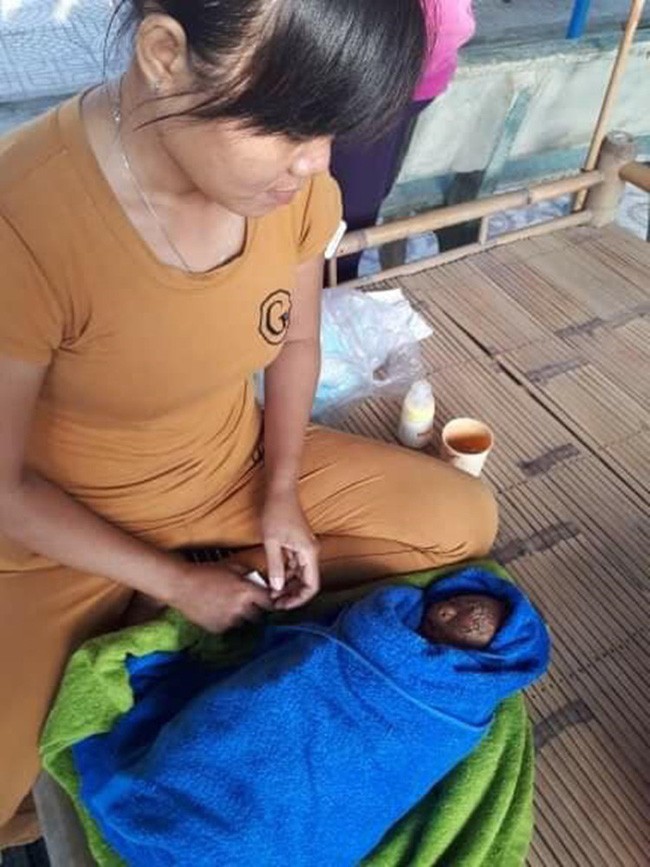 Tây Ninh: Bé trai chưa đầy 1 tháng tuổi, người đầy vảy ngứa như da trăn bị bố mẹ bỏ rơi ngoài đường - Ảnh 2