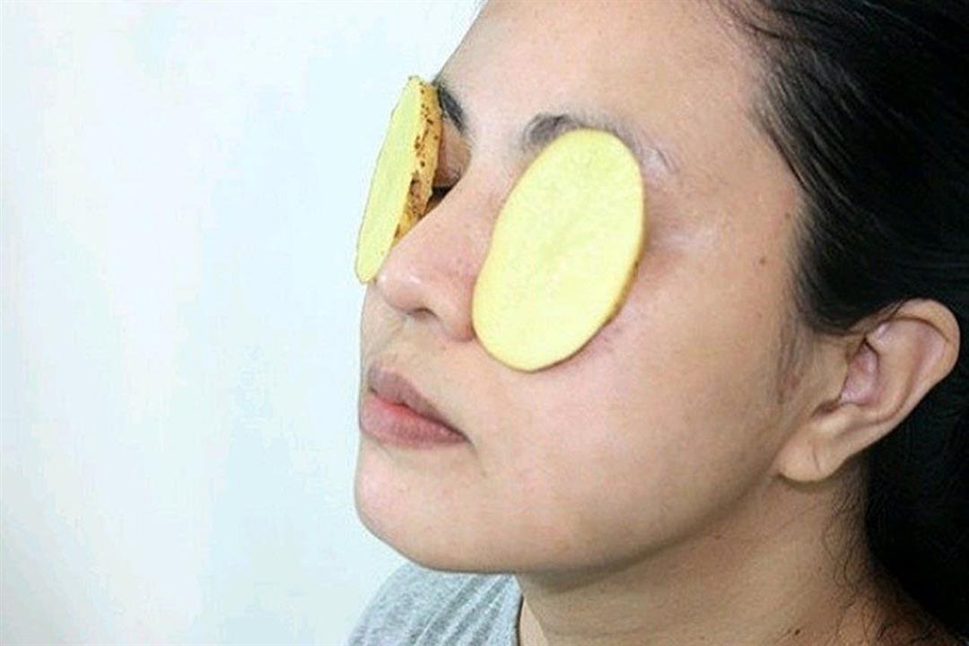 Chỉ cần một củ khoai tây, mắt thâm quầng bẩm sinh cũng có thể chữa trị nhờ dùng loại mặt nạ này - Ảnh 1