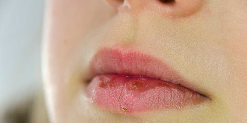 7 lời khuyên giúp phụ nữ sở hữu đôi môi căng hồng, quyến rũ dù không tô son - Ảnh 1