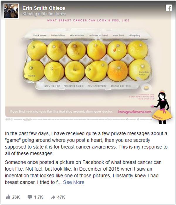 Nhờ vào bức ảnh 12 quả chanh, người phụ nữ bất ngờ phát hiện bị ung thư vú - Ảnh 1