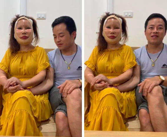 Vừa hoàn tất ca phẫu thuật thẩm mỹ không lâu, cô dâu 62 tuổi nay lại nắm tay chồng xuất hiện với gương mặt sưng phồng, băng bó khắp mặt - Ảnh 3