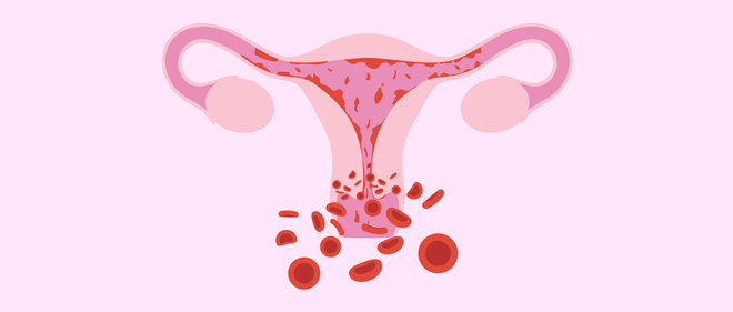 5 bệnh thường gặp ở cổ tử cung mà con gái không nên chủ quan bỏ qua - Ảnh 3