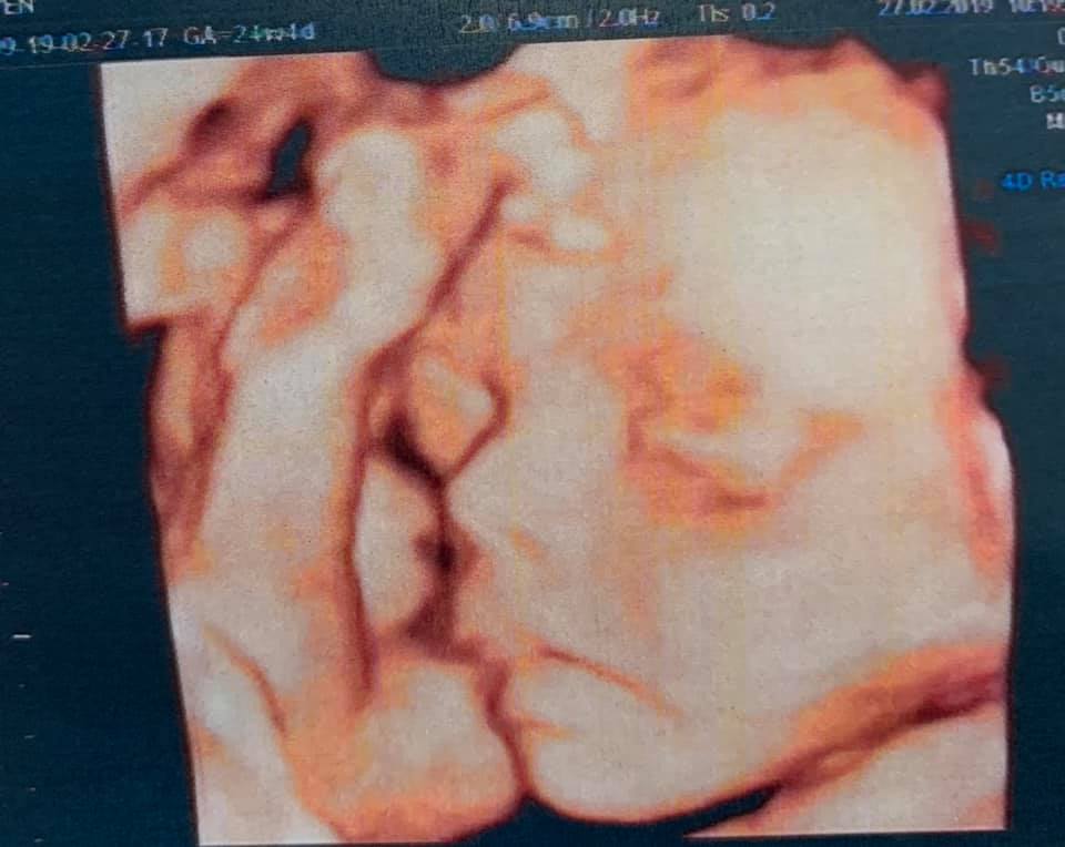 Khoe ảnh siêu âm thai 5 tháng tuổi, Hải Băng tiết lộ giới tính và điểm đặc biệt về con thứ 3 - Ảnh 2