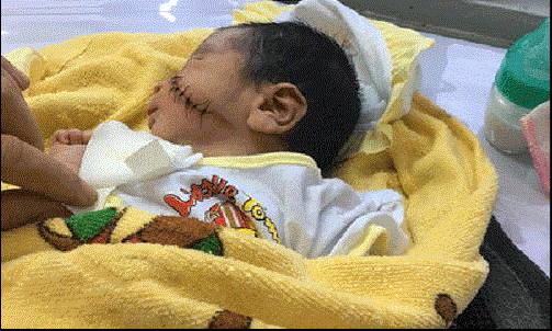 Tình hình sức khỏe hiện tại của bé sơ sinh bị chôn sống ở Bình Thuận - Ảnh 1