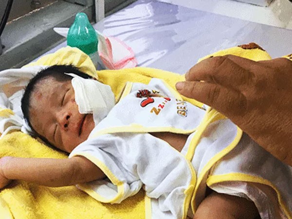 Tình hình sức khỏe hiện tại của bé sơ sinh bị chôn sống ở Bình Thuận - Ảnh 2