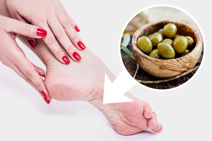 10 mẹo dưỡng da chân vừa dễ thực hiện lại hiệu quả cao, chị em hãy thử để sở hữu đôi bàn chân nuột nà - Ảnh 3