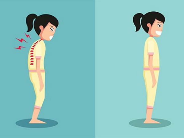 Thường xuyên bị đau lưng có thể khắc phục ngay bằng một số phương pháp sau - Ảnh 4