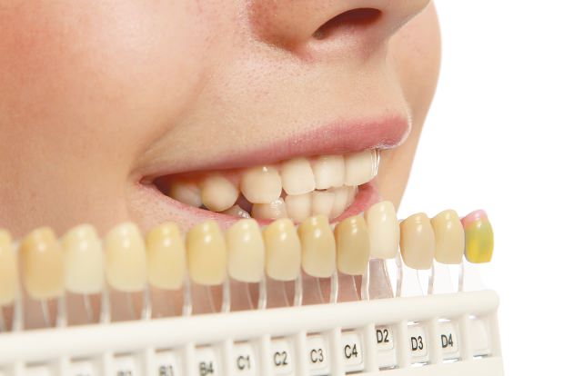 Sở hữu nụ cười tỏa nắng với cách làm trắng răng cực đơn giản tại nhà - Ảnh 1