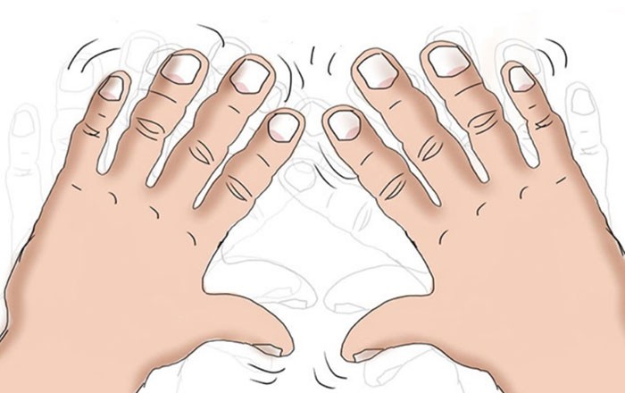 7 dấu hiệu cảnh báo bệnh nguy hiểm biểu hiện trên bàn tay của bạn - Ảnh 6