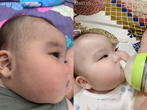 Nhìn đôi má bánh bao của 'cậu bé Bút Chì' phiên bản đời thực, chẳng ai ngờ bé từng sinh non đến 1 tháng - Ảnh 2