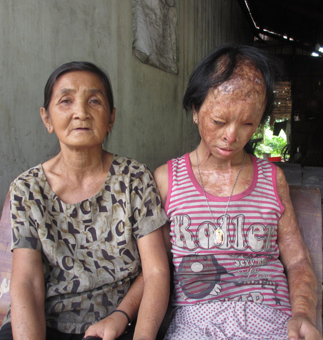 Cháu gái mù lòa vì bị tình địch của mẹ tạt axit, bà nội lặn lội lên TPHCM xin đôi mắt của tử tù Nguyễn Hữu Tình - Ảnh 1