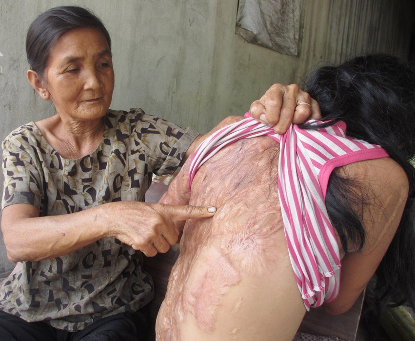 Cháu gái mù lòa vì bị tình địch của mẹ tạt axit, bà nội lặn lội lên TPHCM xin đôi mắt của tử tù Nguyễn Hữu Tình - Ảnh 2