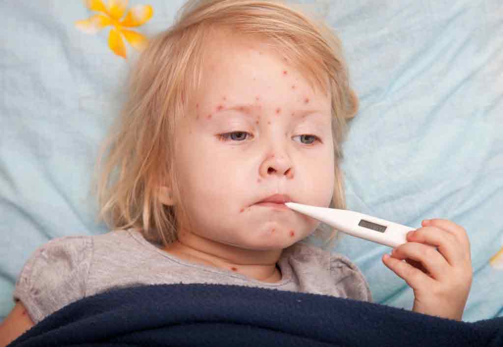 12 triệu chứng sốt siêu vi dễ nhận biết nhất ở trẻ em - Ảnh 3