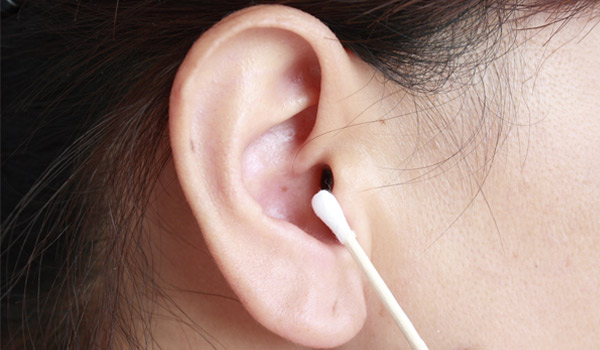 Cẩn thận khi điều trị mụn trong lỗ tai kẻo mang tật - Ảnh 2