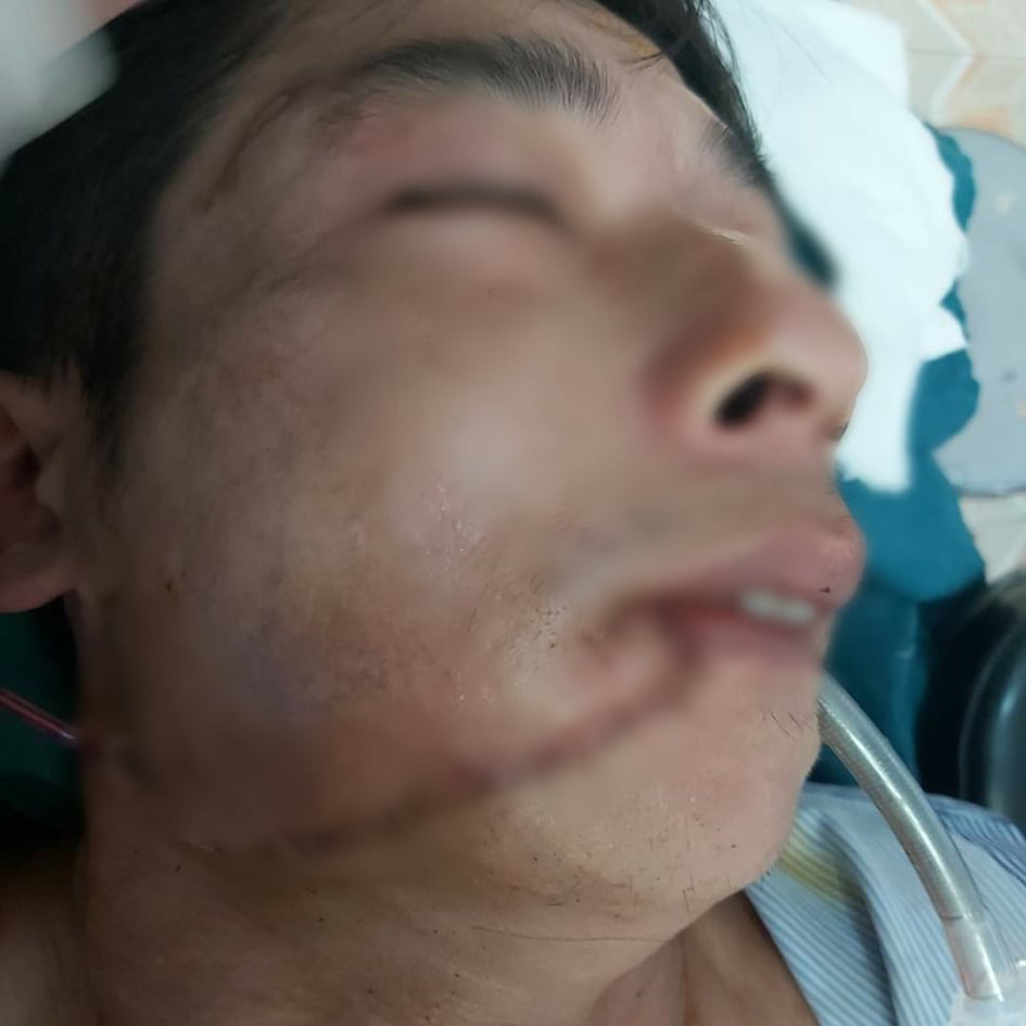 Hà Tĩnh: Người đàn ông bị trâu húc rách mặt khi vào rừng - Ảnh 1