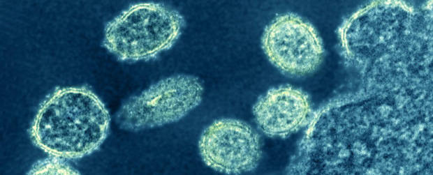 Những sự thật đáng sợ về dịch cúm lợn chủng mới tại Trung Quốc: Virus mang sự kết hợp hủy diệt, chưa có bất kỳ miễn dịch nào tồn tại - Ảnh 3