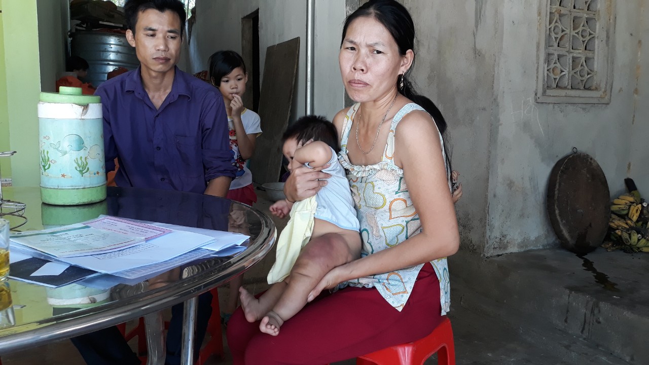 Đau đáu ánh mắt bé gái 7 tháng tuổi mang 'chân voi' đang giành giật sự sống vì căn bệnh hiếm gặp - Ảnh 3