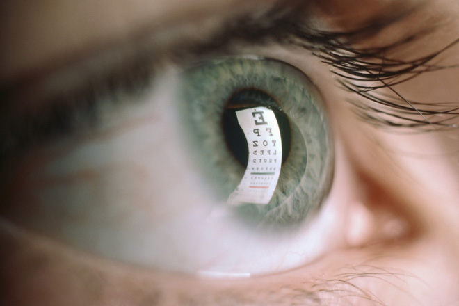 Nhận biết các bệnh dễ mắc qua những triệu chứng bất thường ở đôi mắt - Ảnh 5