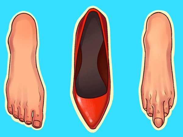 Nếu không muốn tổn hại đến sức khỏe, biến dạng bàn chân, phụ nữ nên hạn chế đi 6 kiểu giày này - Ảnh 1