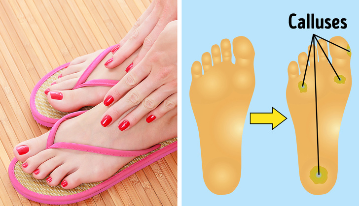 Nếu không muốn tổn hại đến sức khỏe, biến dạng bàn chân, phụ nữ nên hạn chế đi 6 kiểu giày này - Ảnh 2