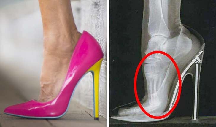 Nếu không muốn tổn hại đến sức khỏe, biến dạng bàn chân, phụ nữ nên hạn chế đi 6 kiểu giày này - Ảnh 3
