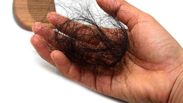 Ngoài ung thư, đây là những nguyên nhân gây rụng tóc nhiều ở phụ nữ ít ai biết đến - Ảnh 1